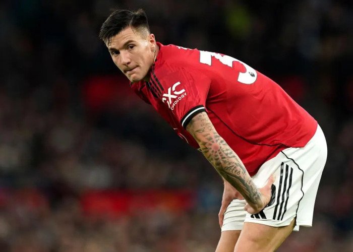 Tottenham vs Manchester United: Ruben Amorim Kasih Kabar Buruk soal Cedera Benjamin Sesko